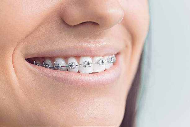 Why Choose Us for Your Dental Needs in Phoenix, OR